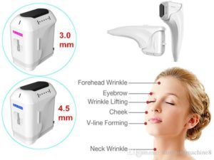 HIFU machines and the parts of the face it can treat